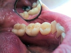 dental technician oldham